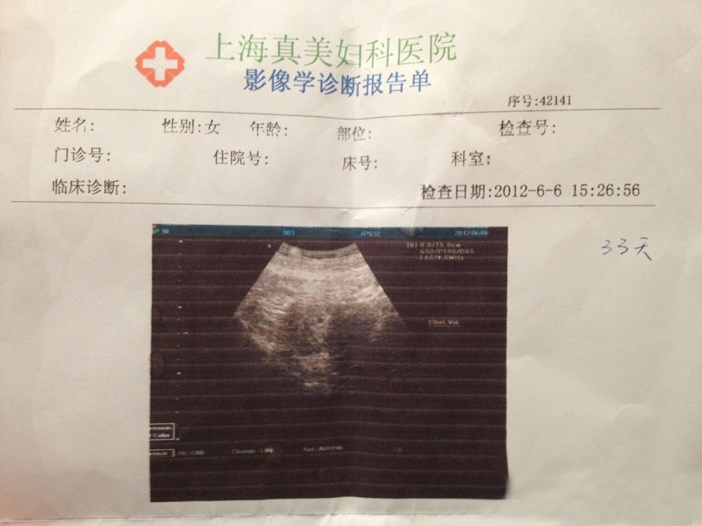 早孕b超报告单图片