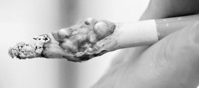 英国推全新禁烟广告 被评“史上最恶心”(图)