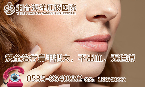 鼻甲肥大症状,鼻甲肥大怎么办