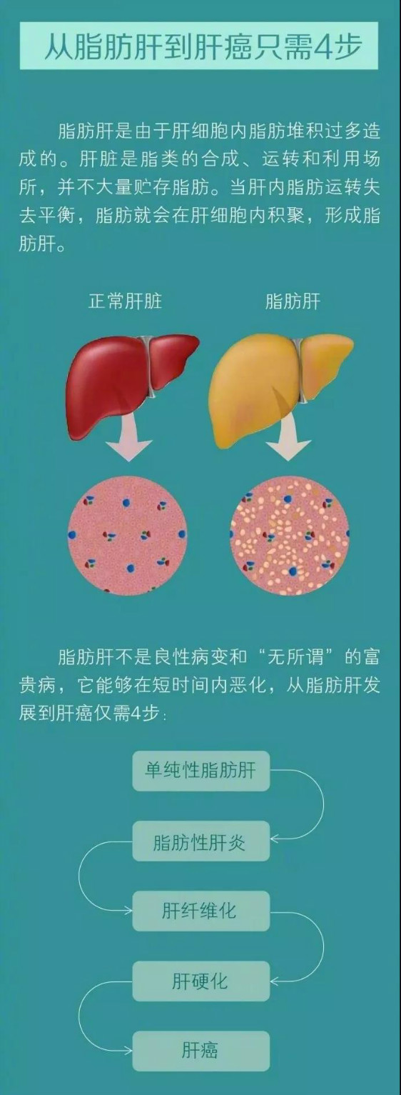 很多慢性脂肪肝的患者到了一定阶段,会产生持续的慢性脂肪性肝炎